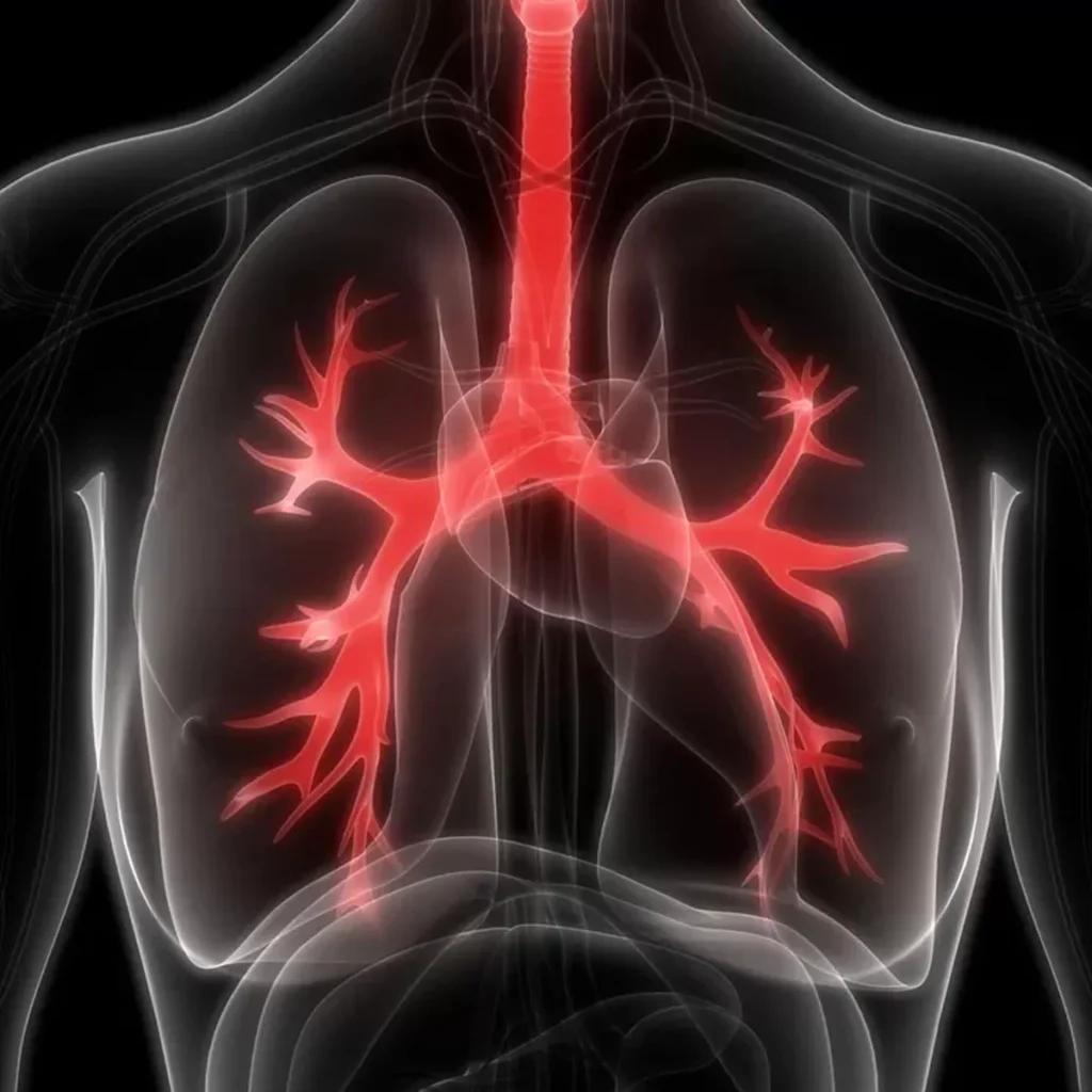 Cystic Fibrosis: New Advances and Symptom Management