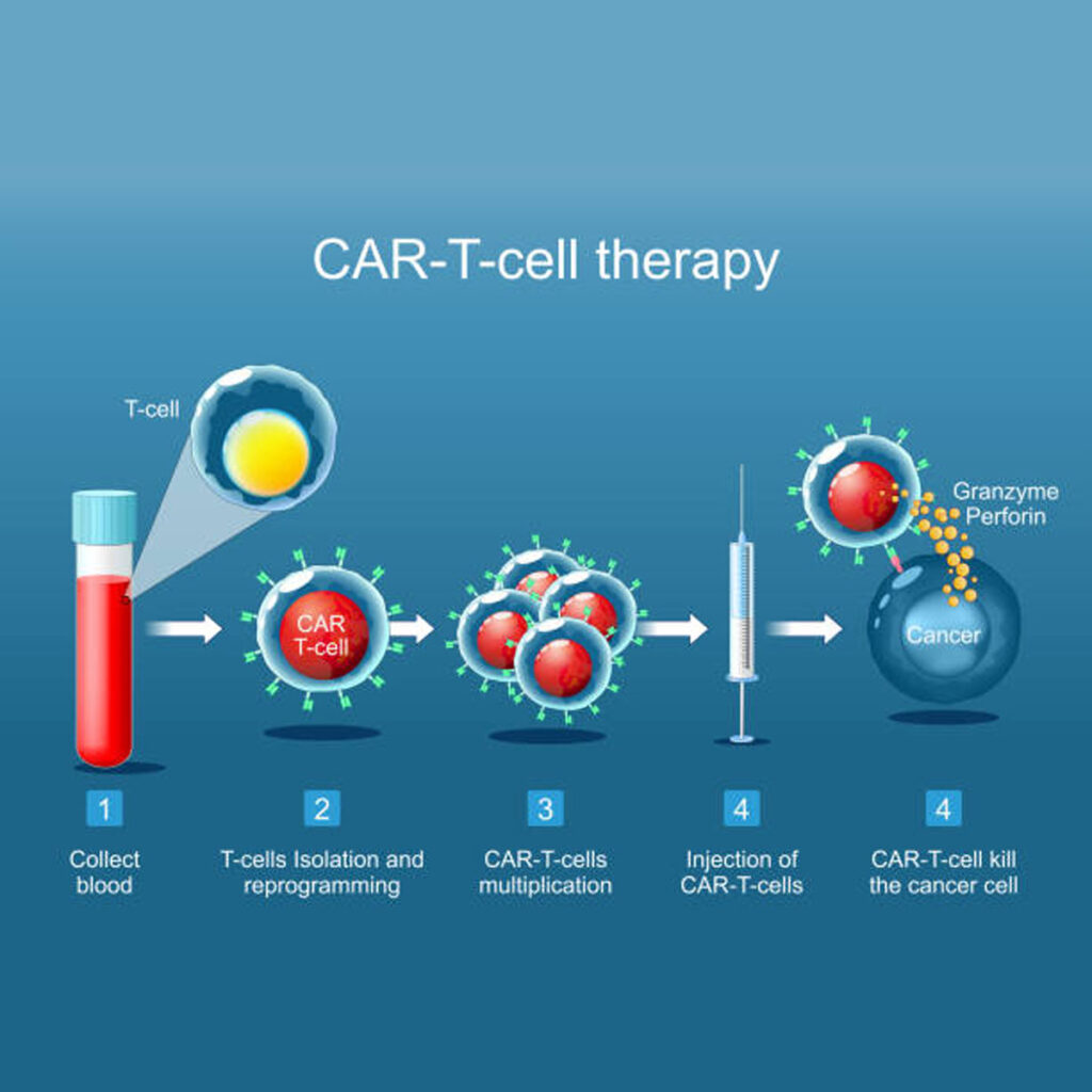 car t cell, immunotherapy, lymphoma