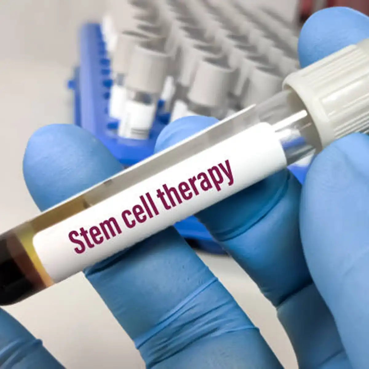 stem cell, anthony nolan, donor register